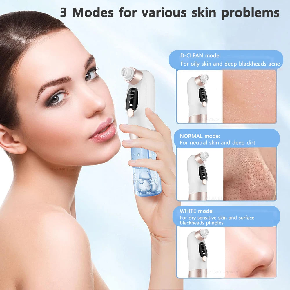 ClearSkin Pro: Removedor de Cravos Elétrico com Tecnologia de Ciclo de Água