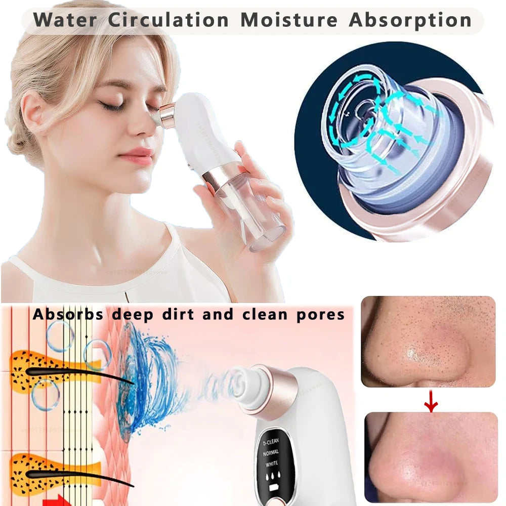 ClearSkin Pro: Elektrischer Cravos-Entferner mit Wasserkreislauf-Technologie